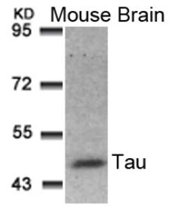 Western blot analysis of lysed extracts from Mouse Brain tissue using Tau (Ab-181).