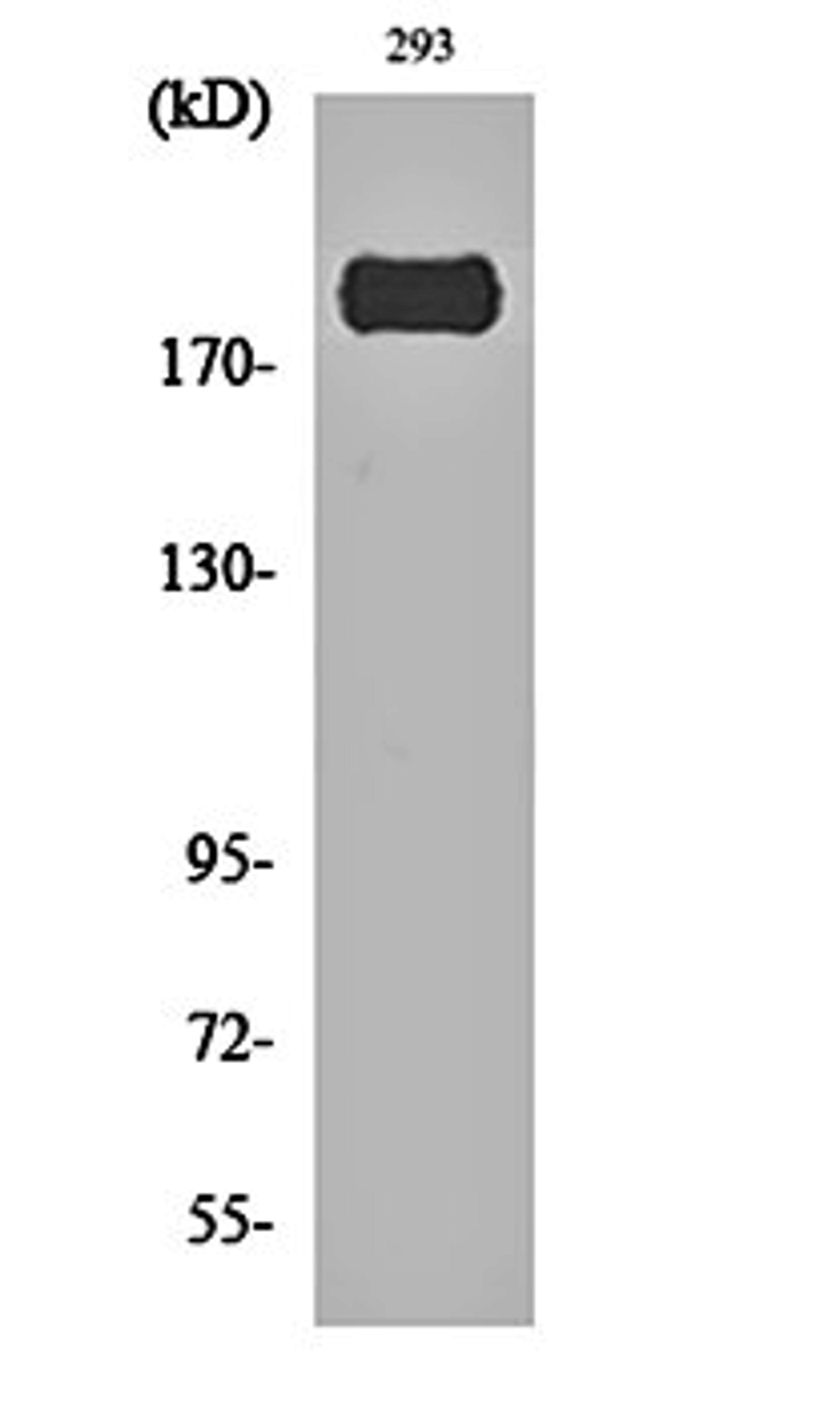 Western blot analysis of 293 cell lysates using IRS-1 (phospho-S307) antibody