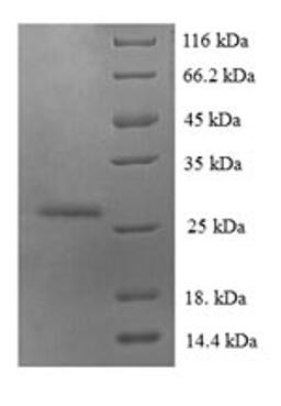 (Tris-Glycine gel) Discontinuous SDS-PAGE (reduced) with 5% enrichment gel and 15% separation gel.
