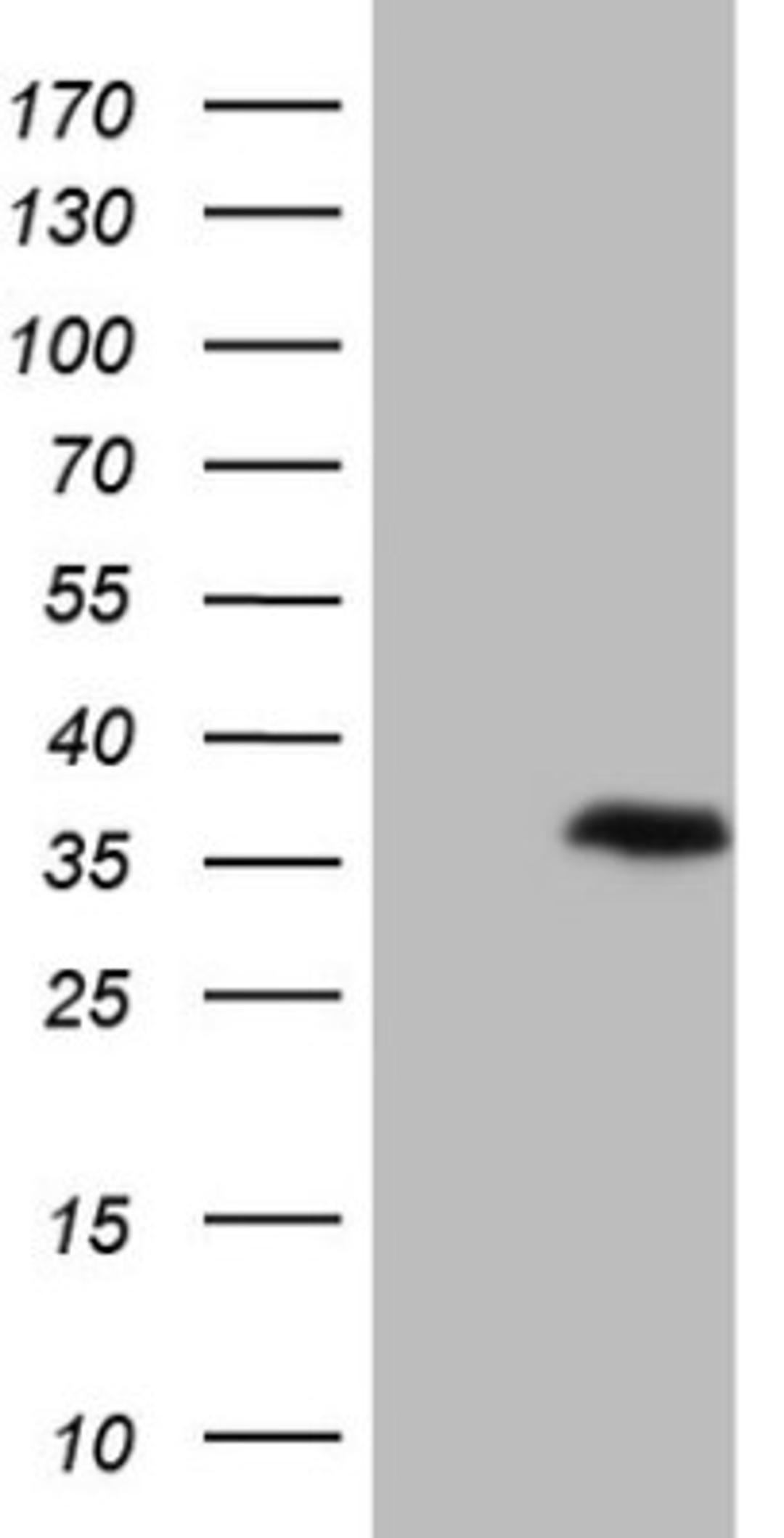 Western Blot: Galectin-9 Antibody (1D12) [NBP2-45619] - Analysis of HEK293T cells were transfected with the pCMV6-ENTRY control (Left lane) or pCMV6-ENTRY Galectin-9.