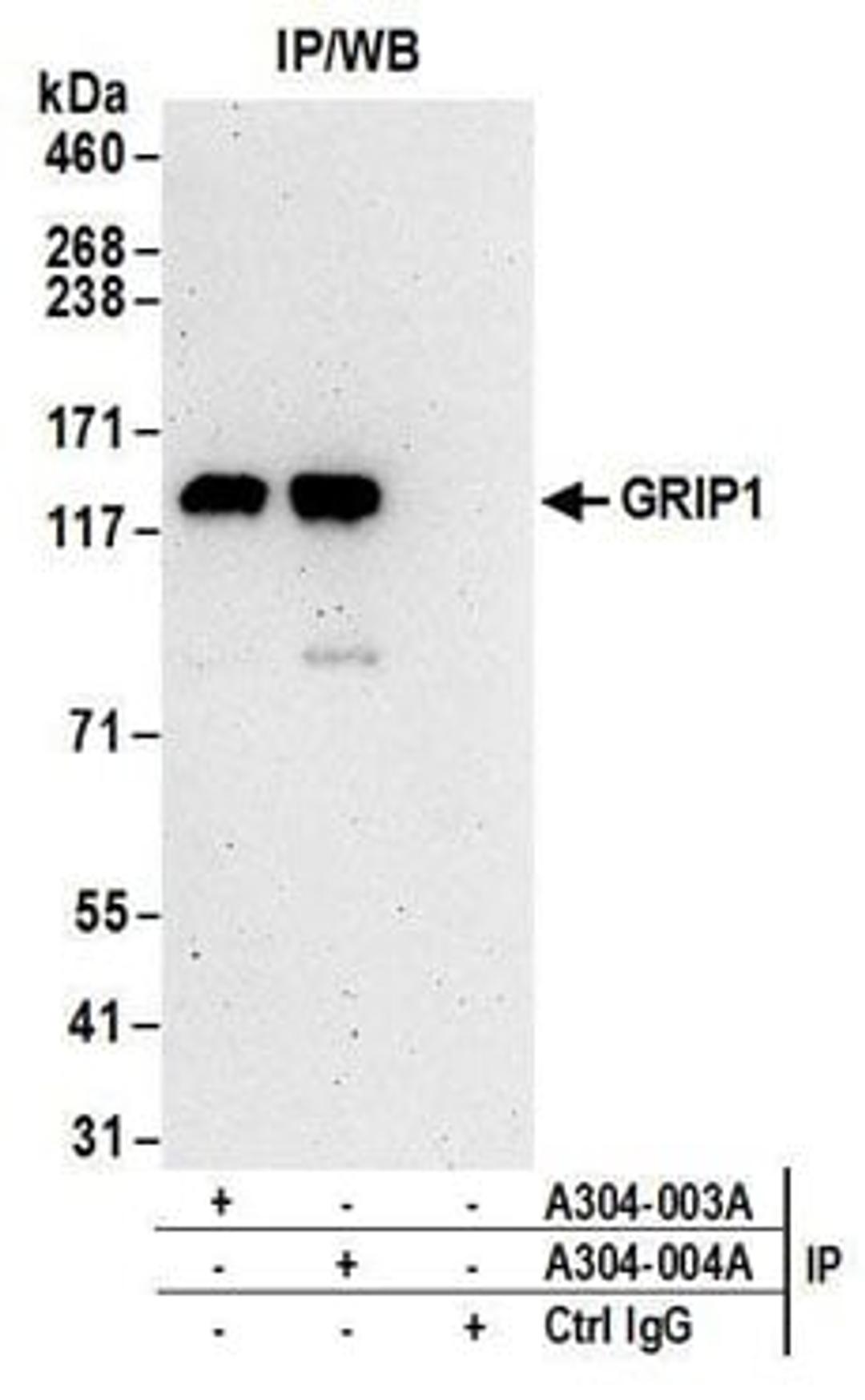 Detection of human GRIP1 by western blot of immunoprecipitates.