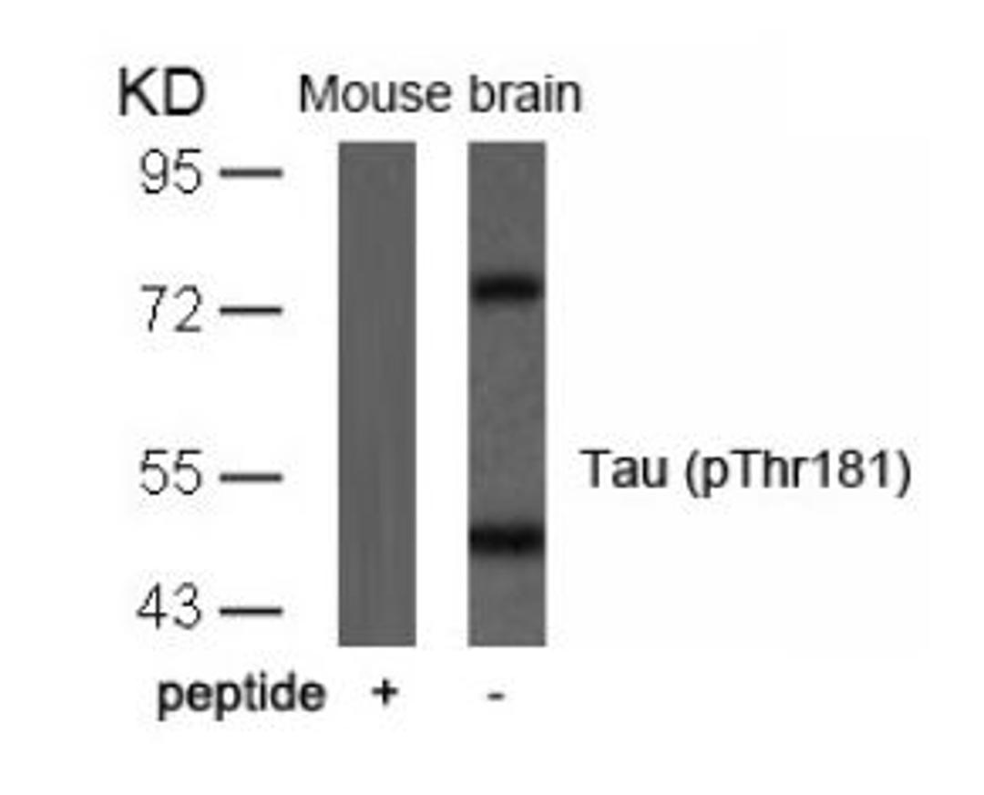 Western blot analysis of lysed extracts from mouse brain tissue using Tau (Phospho-Thr181).