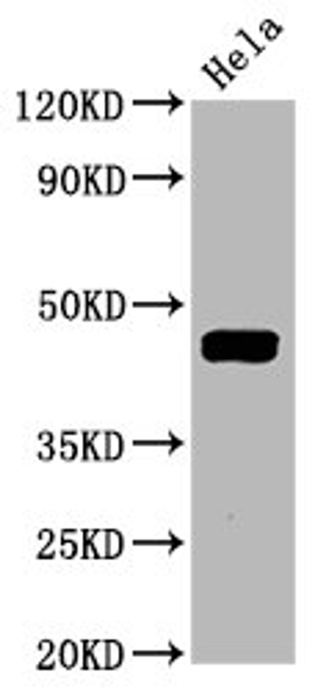 Western Blot. Positive WB detected in Hela whole cell lysate. All lanes Phospho-MAP2K1 antibody at 1.645μg/ml. Secondary. Goat polyclonal to rabbit IgG at 1/50000 dilution. Predicted band size: 45 KDa. Observed band size: 45 KDa. 