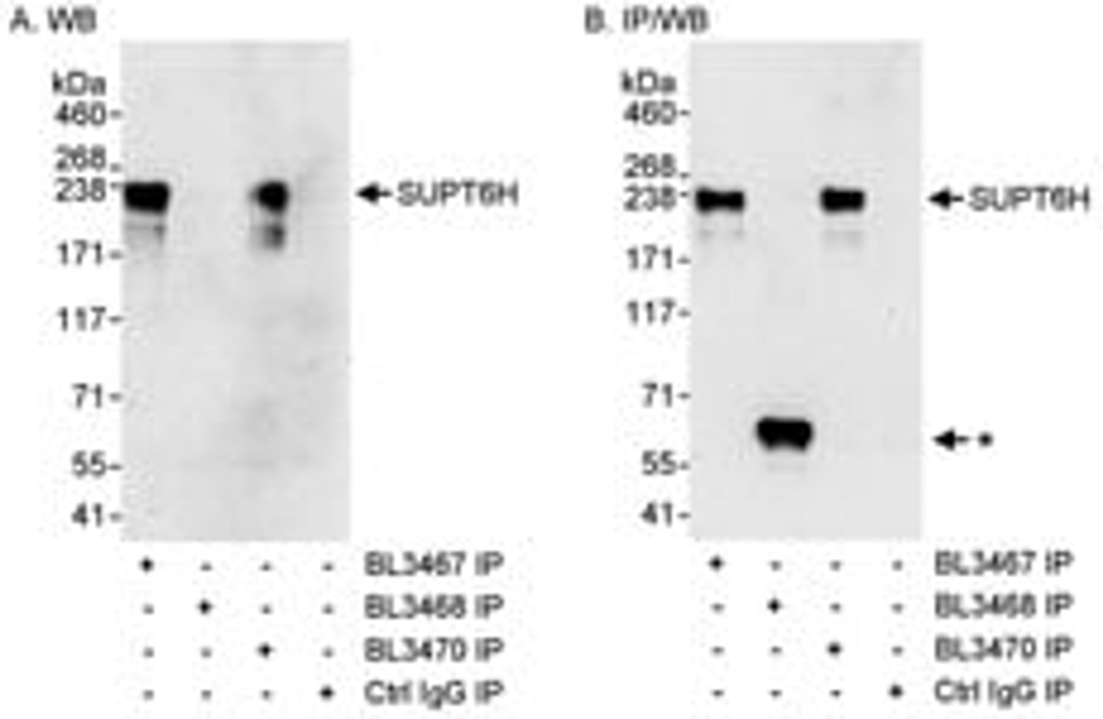 Detection of human SUPT6H by western blot of immunoprecipitates.