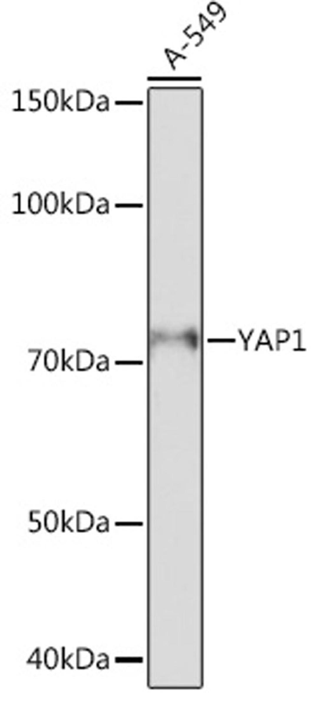 Western blot - YAP1 antibody (A19134)