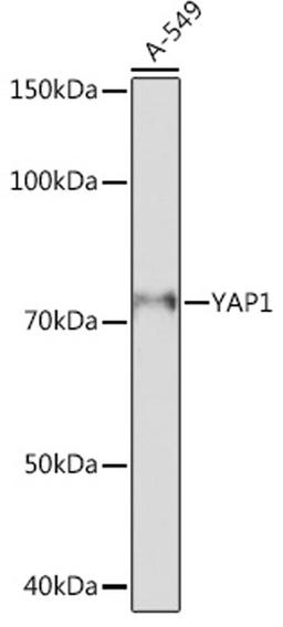 Western blot - YAP1 antibody (A19134)