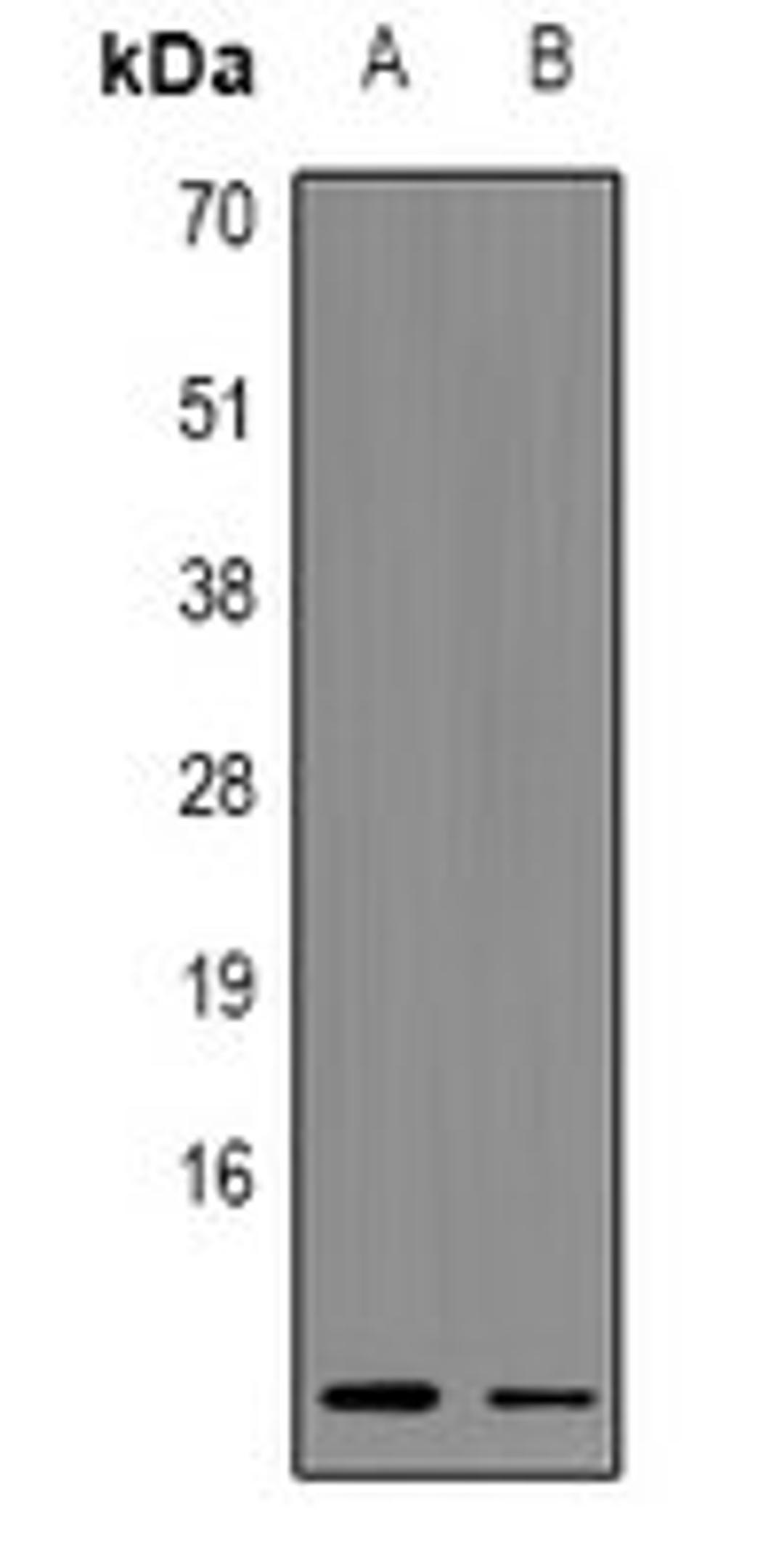 Western blot analysis of A549 (Lane1), rat lung (Lane2) whole cell lysates using MYCBP antibody