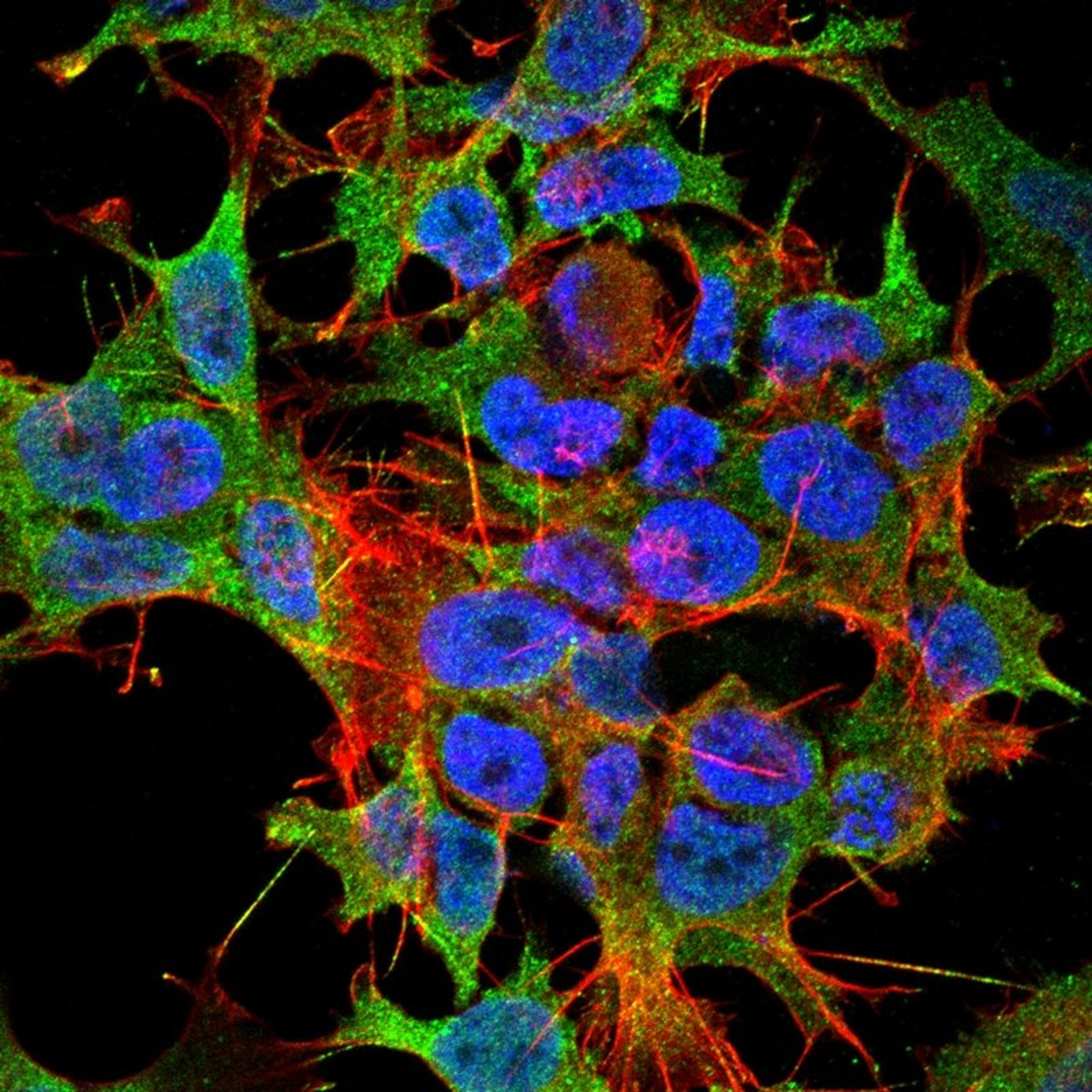 Immunofluorescence analysis of neuroblastoma cell line sk-n-be using TASK1 Potassium Channel antibody