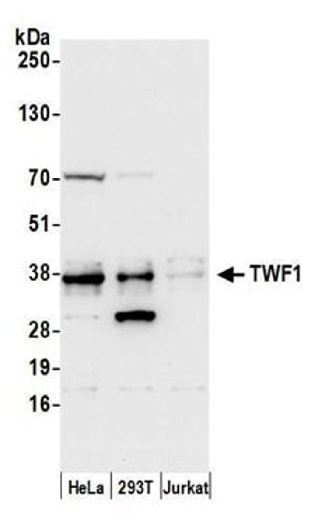 Detection of human TWF1 by western blot.