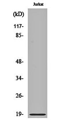 Western blot analysis of jurkat cell lysates using Op18 (phospho-S25) antibody