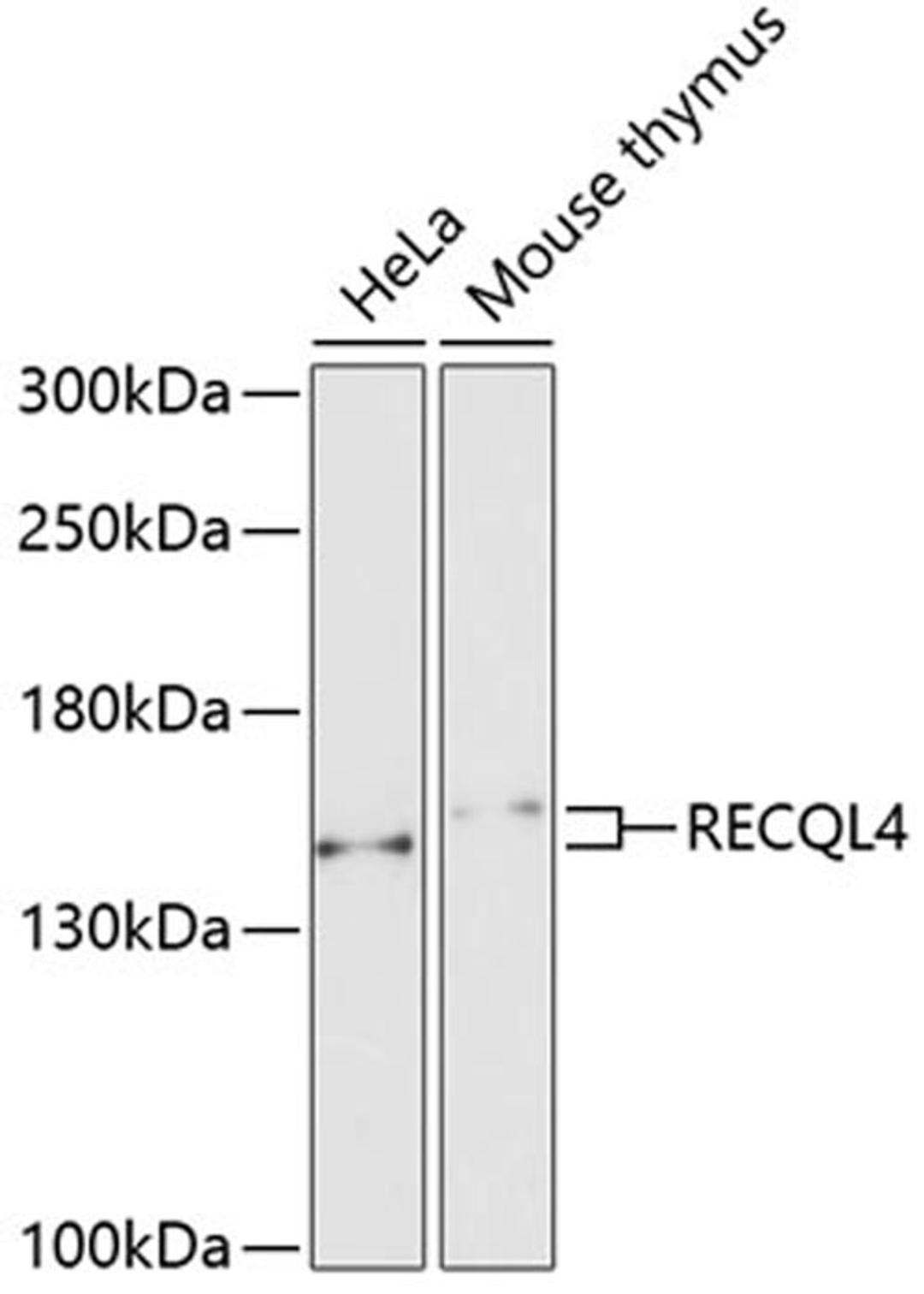 Western blot - RECQL4 antibody (A6846)