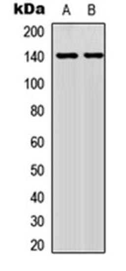 Western blot analysis of MCF7 (Lane1), HeLa (Lane2) whole cell using NFAT3 (phospho-S676) antibody