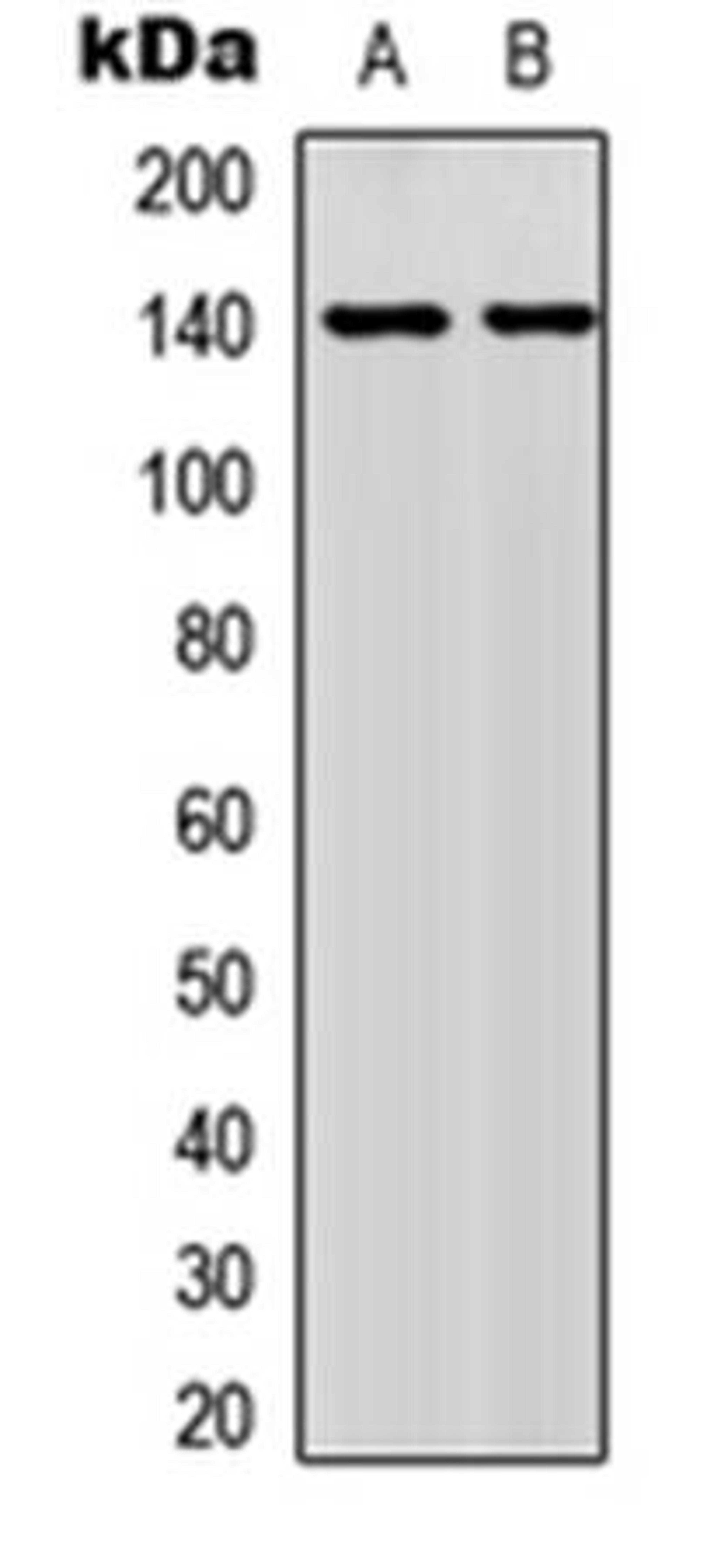 Western blot analysis of MCF7 (Lane1), HeLa (Lane2) whole cell using NFAT3 (phospho-S676) antibody