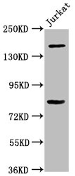 Western Blot. Positive WB detected in: Jurkat whole cell lysate. All lanes: BCL9 antibody at 3.4µg/ml. Secondary. Goat polyclonal to rabbit IgG at 1/50000 dilution. Predicted band size: 150 kDa. Observed band size: 150 kDa