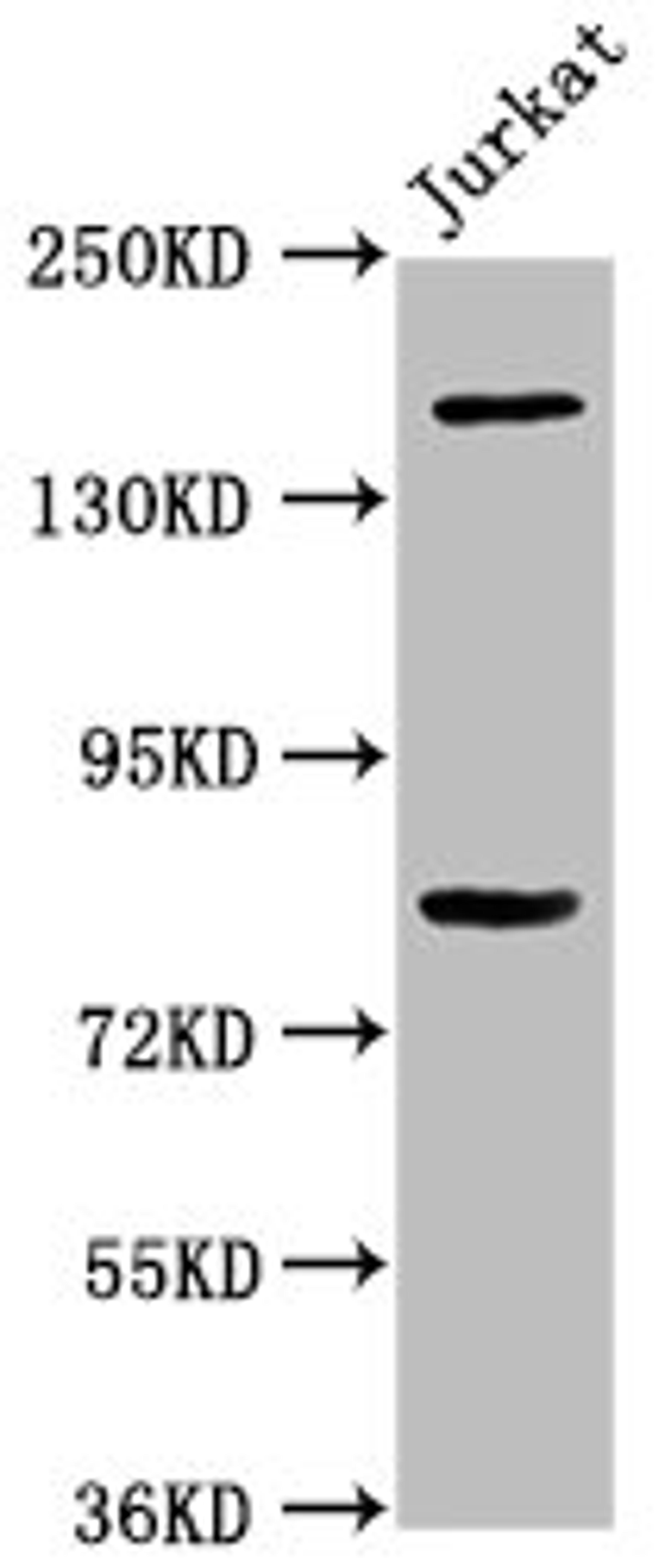 Western Blot. Positive WB detected in: Jurkat whole cell lysate. All lanes: BCL9 antibody at 3.4µg/ml. Secondary. Goat polyclonal to rabbit IgG at 1/50000 dilution. Predicted band size: 150 kDa. Observed band size: 150 kDa
