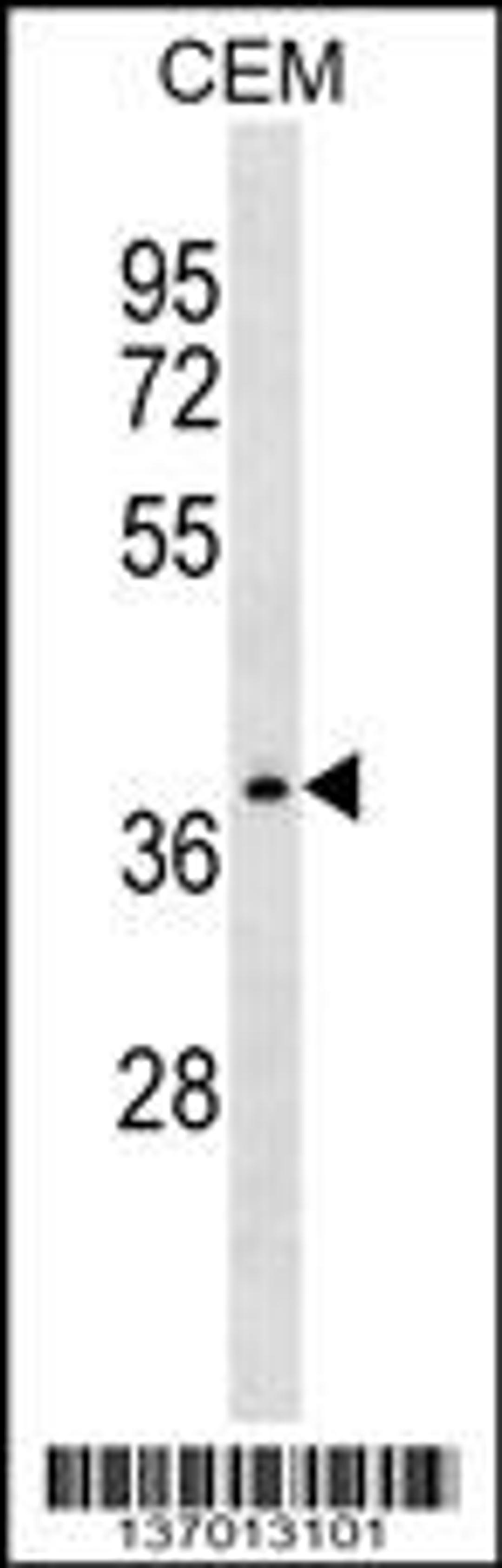 Western blot analysis in CEM cell line lysates (35ug/lane).