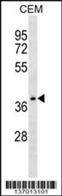 Western blot analysis in CEM cell line lysates (35ug/lane).