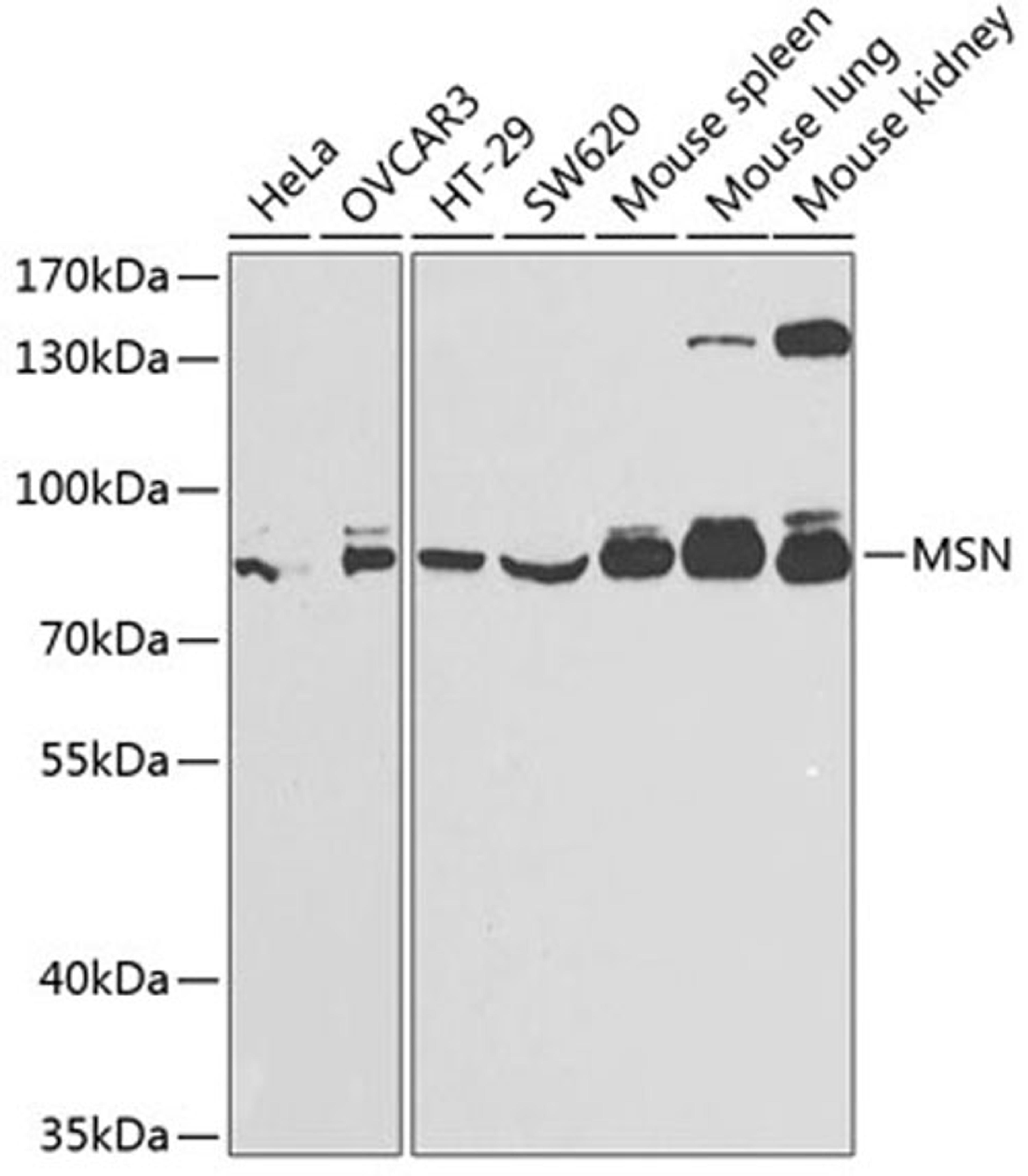 Western blot - MSN antibody (A2178)