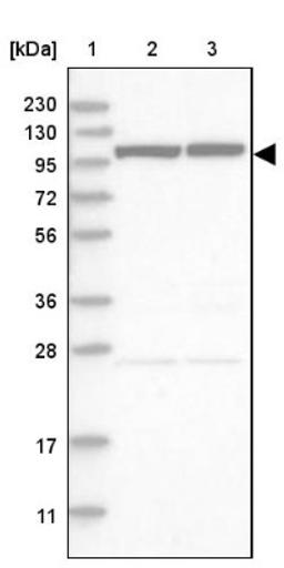 Western Blot: DENND2A Antibody [NBP1-90465] - Lane 1: Marker [kDa] 230, 130, 95, 72, 56, 36, 28, 17, 11<br/>Lane 2: Human cell line RT-4<br/>Lane 3: Human cell line U-251MG sp