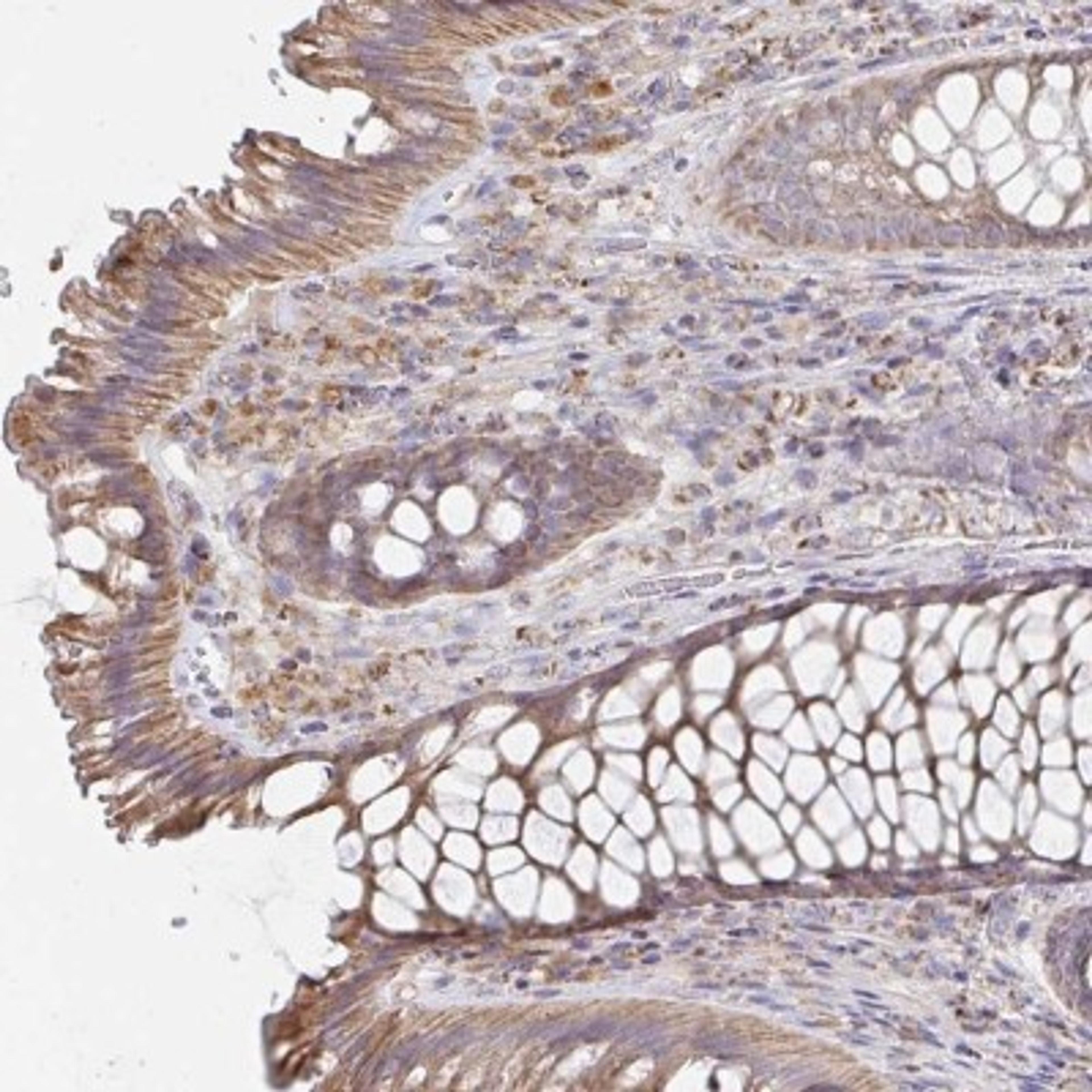 Immunohistochemistry: NKX2.8 Antibody [NBP2-34150] - Immunohistochemical staining of human rectum shows moderate cytoplasmic positivity in glandular cells.