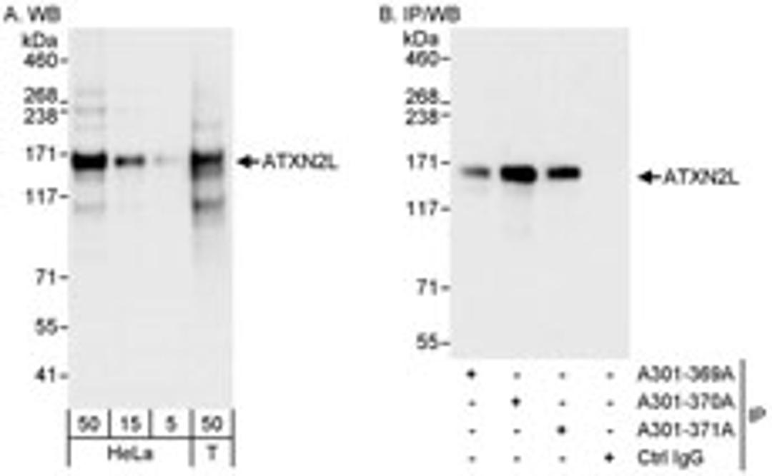 Detection of human ATXN2L by western blot and immunoprecipitation.