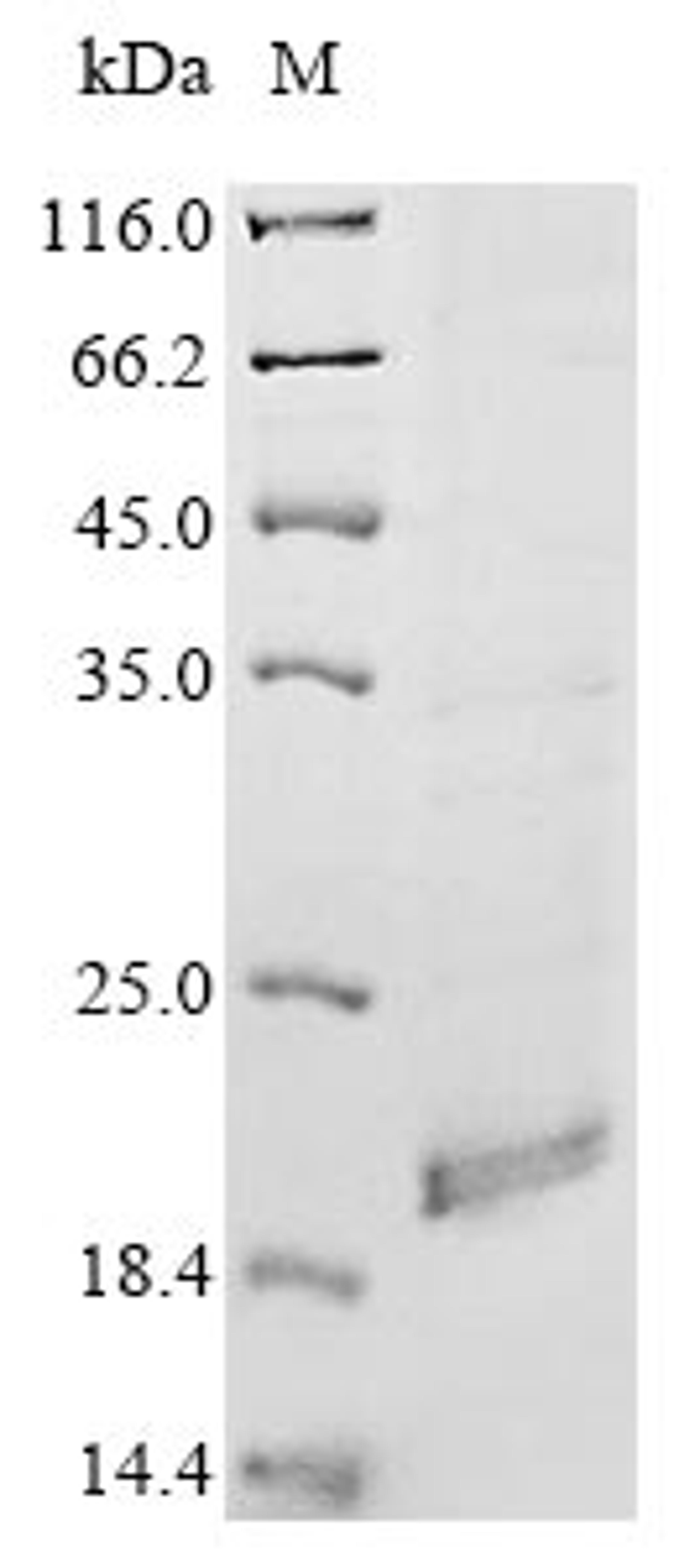 (Tris-Glycine gel) Discontinuous SDS-PAGE (reduced) with 5% enrichment gel and 15% separation gel.