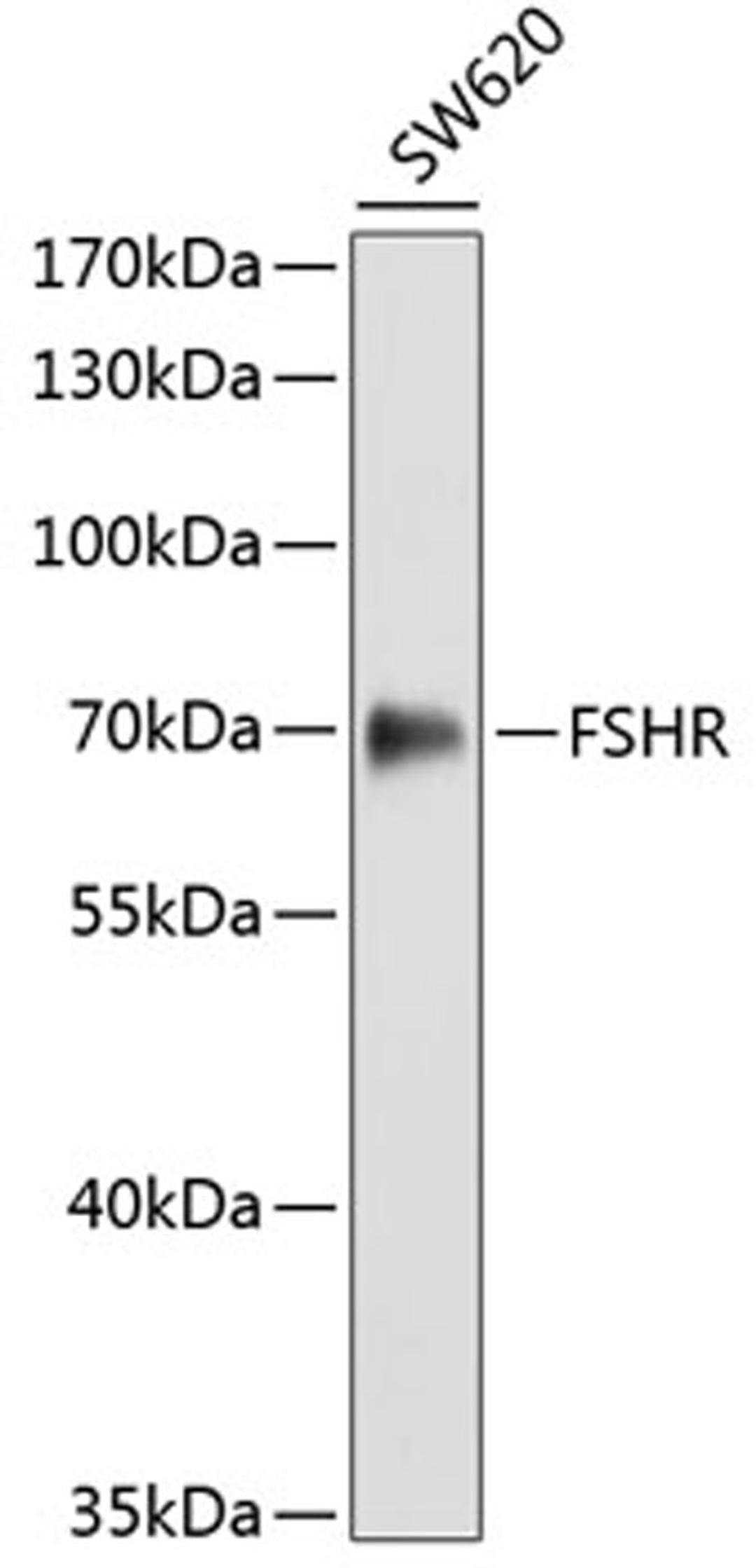 Western blot - FSHR antibody (A3172)
