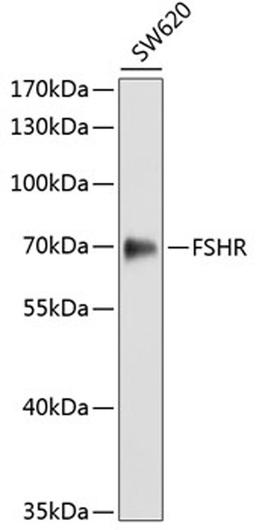 Western blot - FSHR antibody (A3172)