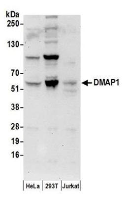 Detection of human DMAP1 by western blot.