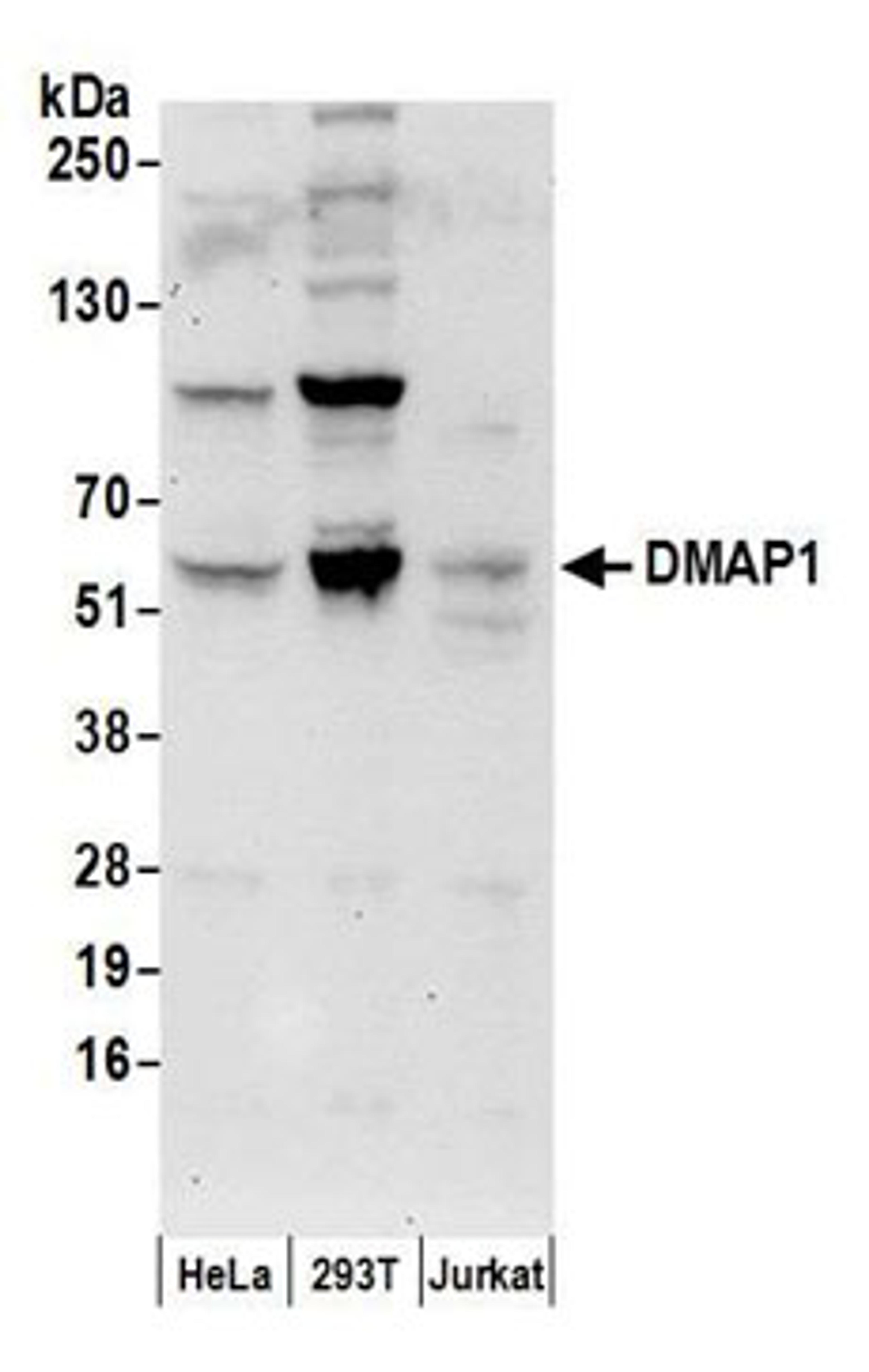 Detection of human DMAP1 by western blot.