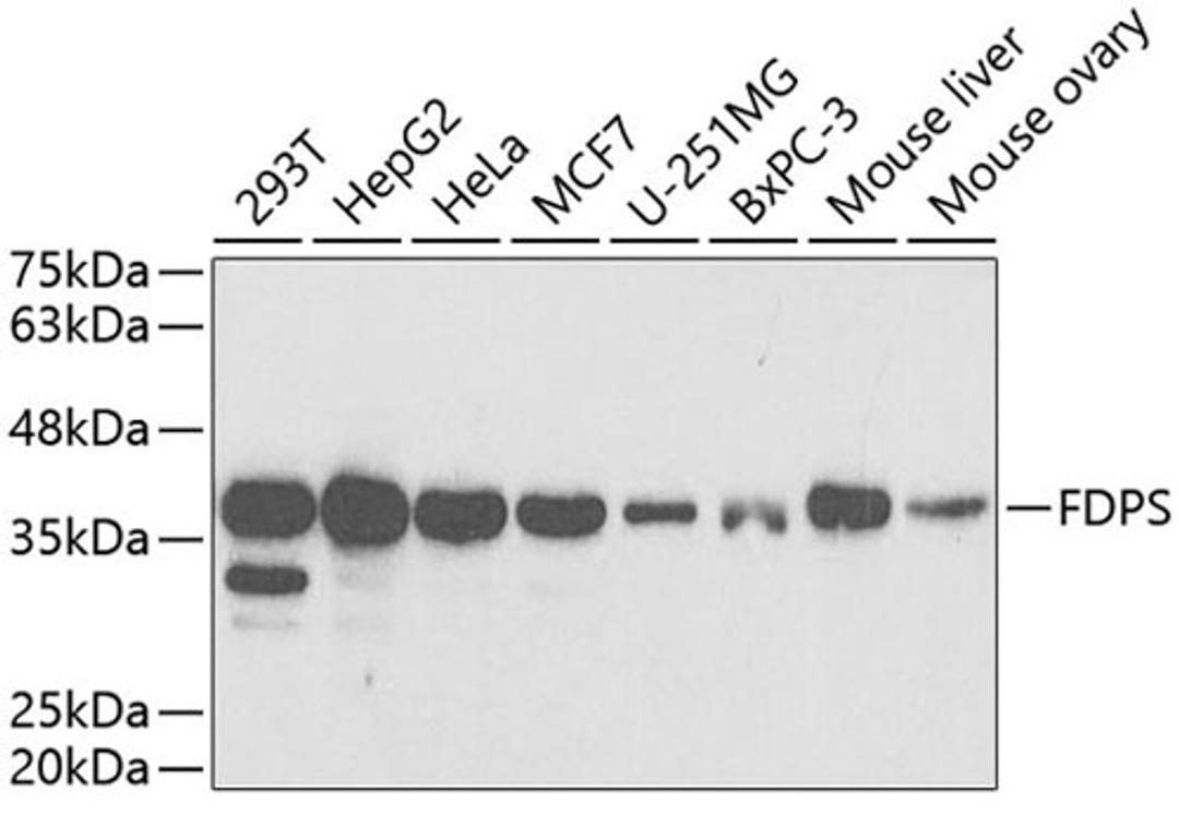 Western blot - FDPS antibody (A5744)