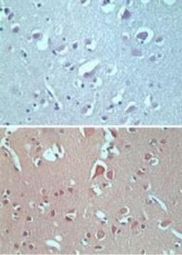 Immunohistochemistry-Paraffin: VANGL2 Antibody [NBP2-24704] - analysis of Van Gogh like-2 in formalin-fixed, paraffin-embedded human brain tissue using an isotype control (top) and this antibody (bottom) at 5 ug/ml.