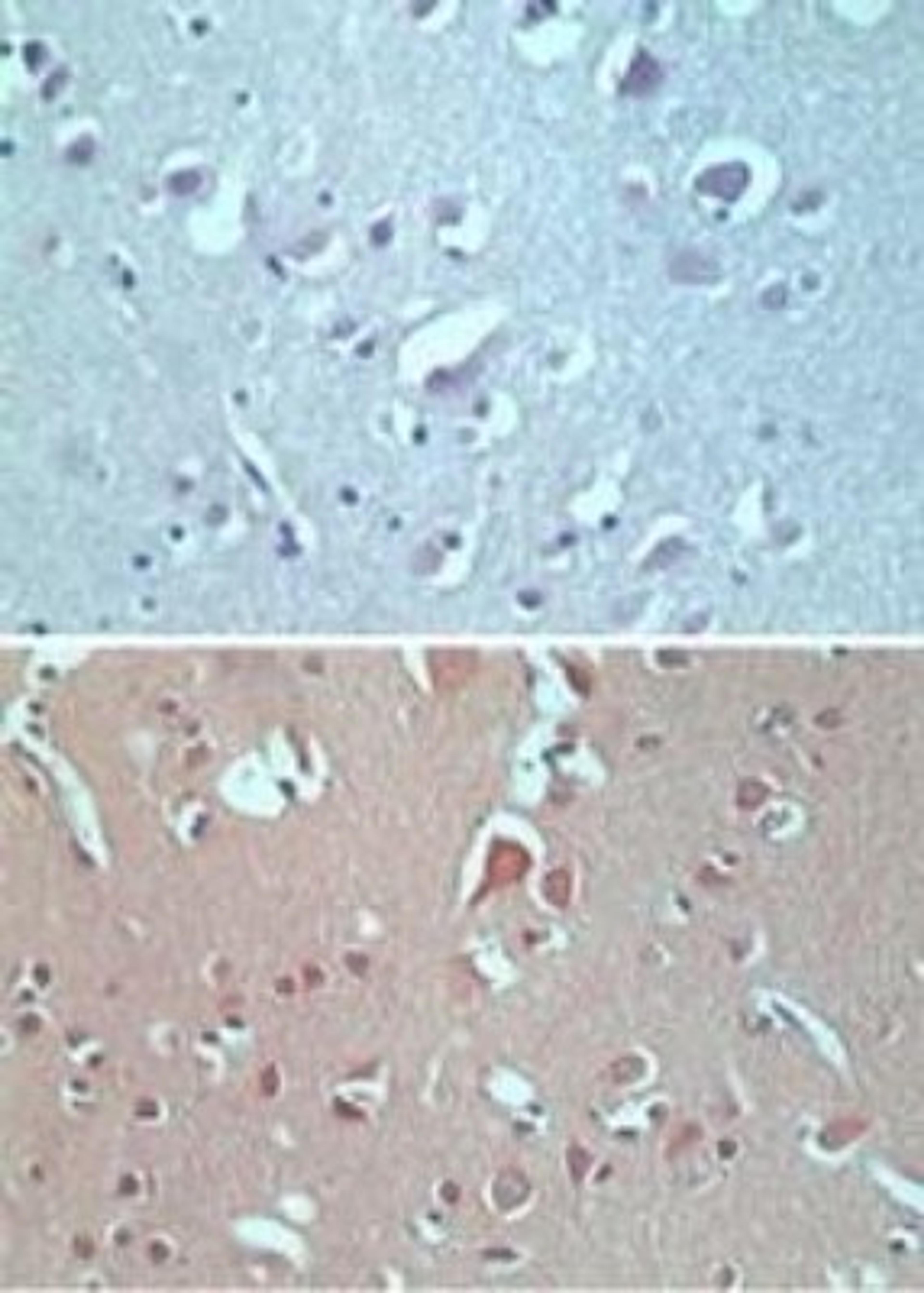 Immunohistochemistry-Paraffin: VANGL2 Antibody [NBP2-24704] - analysis of Van Gogh like-2 in formalin-fixed, paraffin-embedded human brain tissue using an isotype control (top) and this antibody (bottom) at 5 ug/ml.