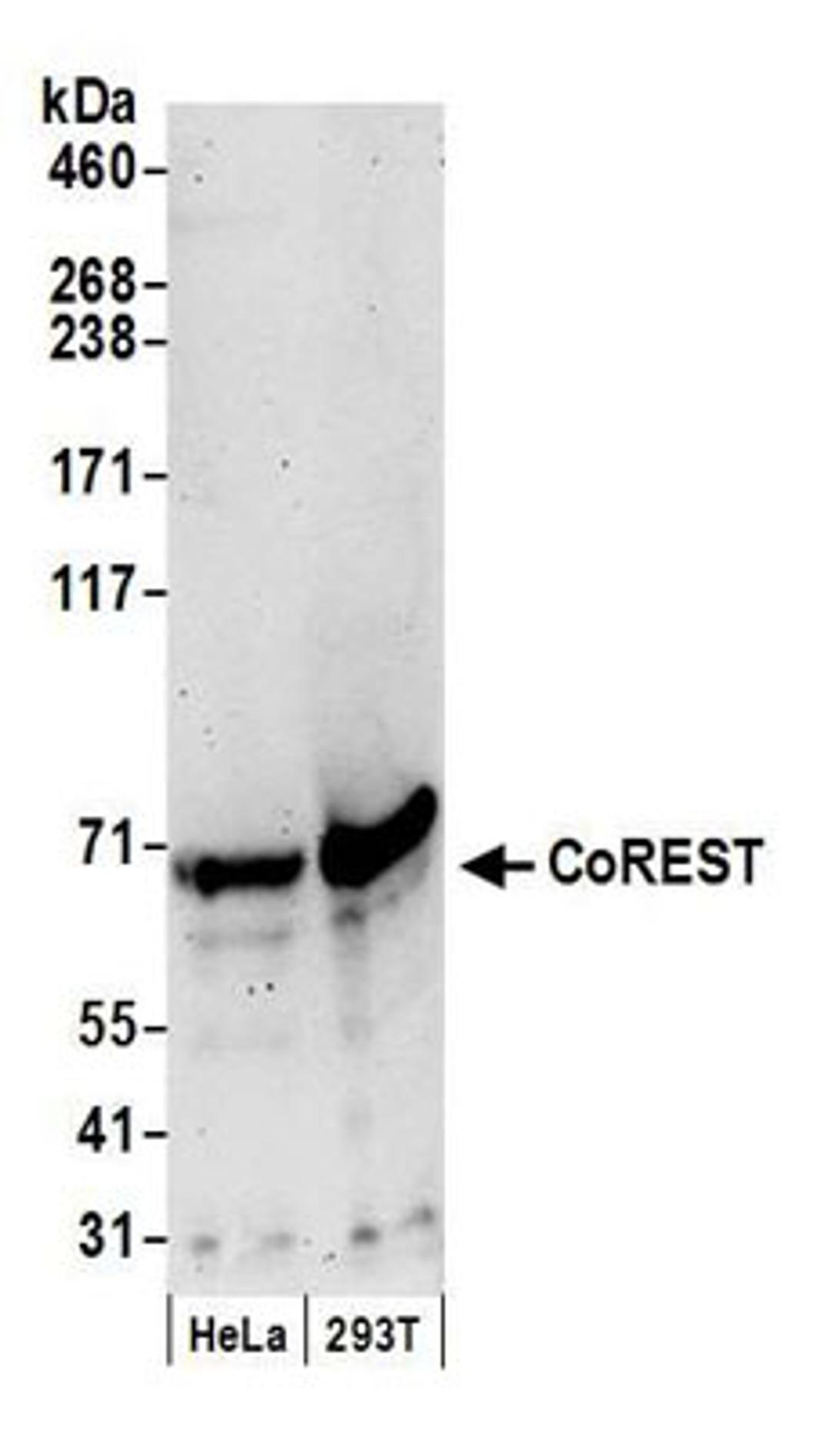 Detection of human CoREST by western blot.