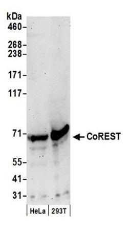 Detection of human CoREST by western blot.