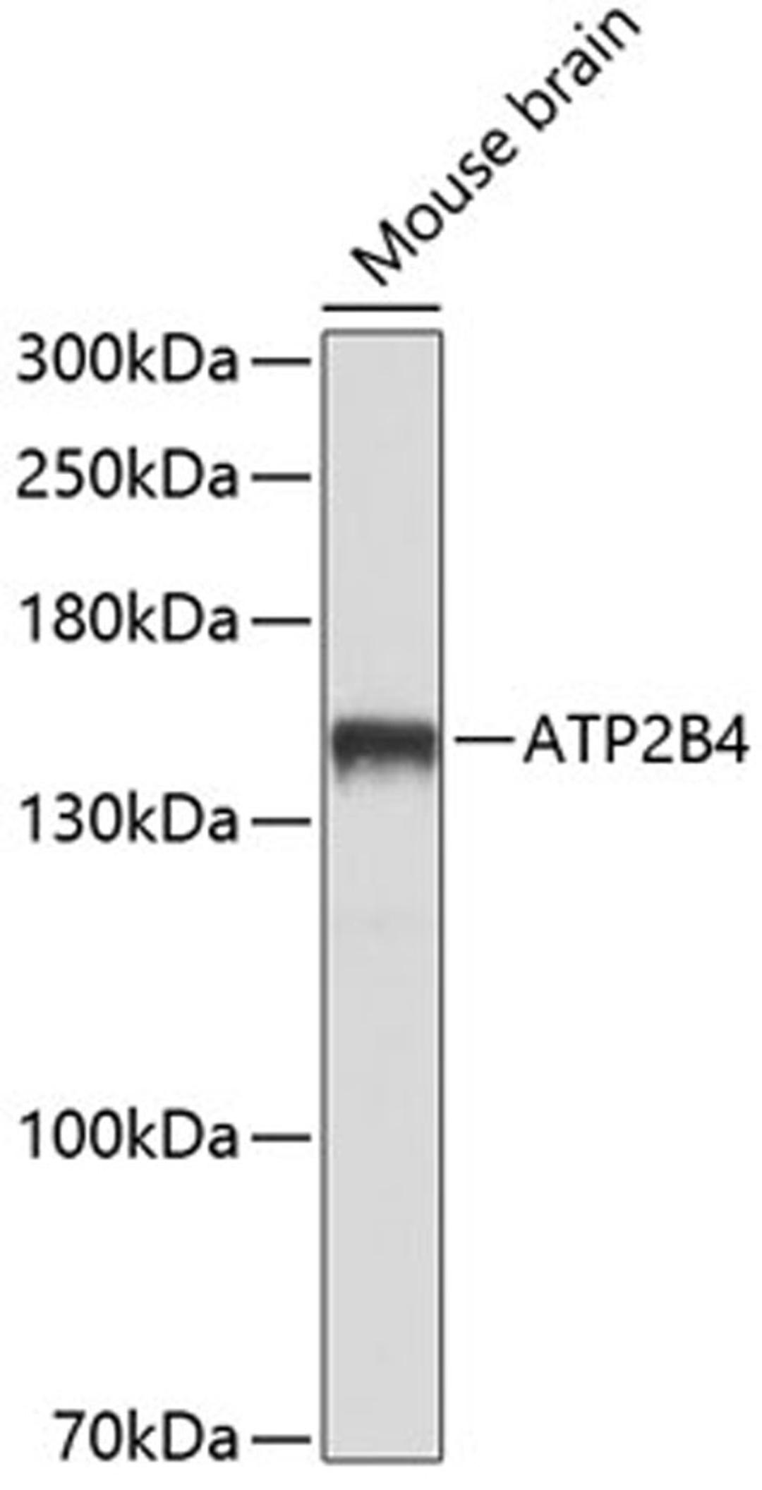 Western blot - ATP2B4 antibody (A10105)