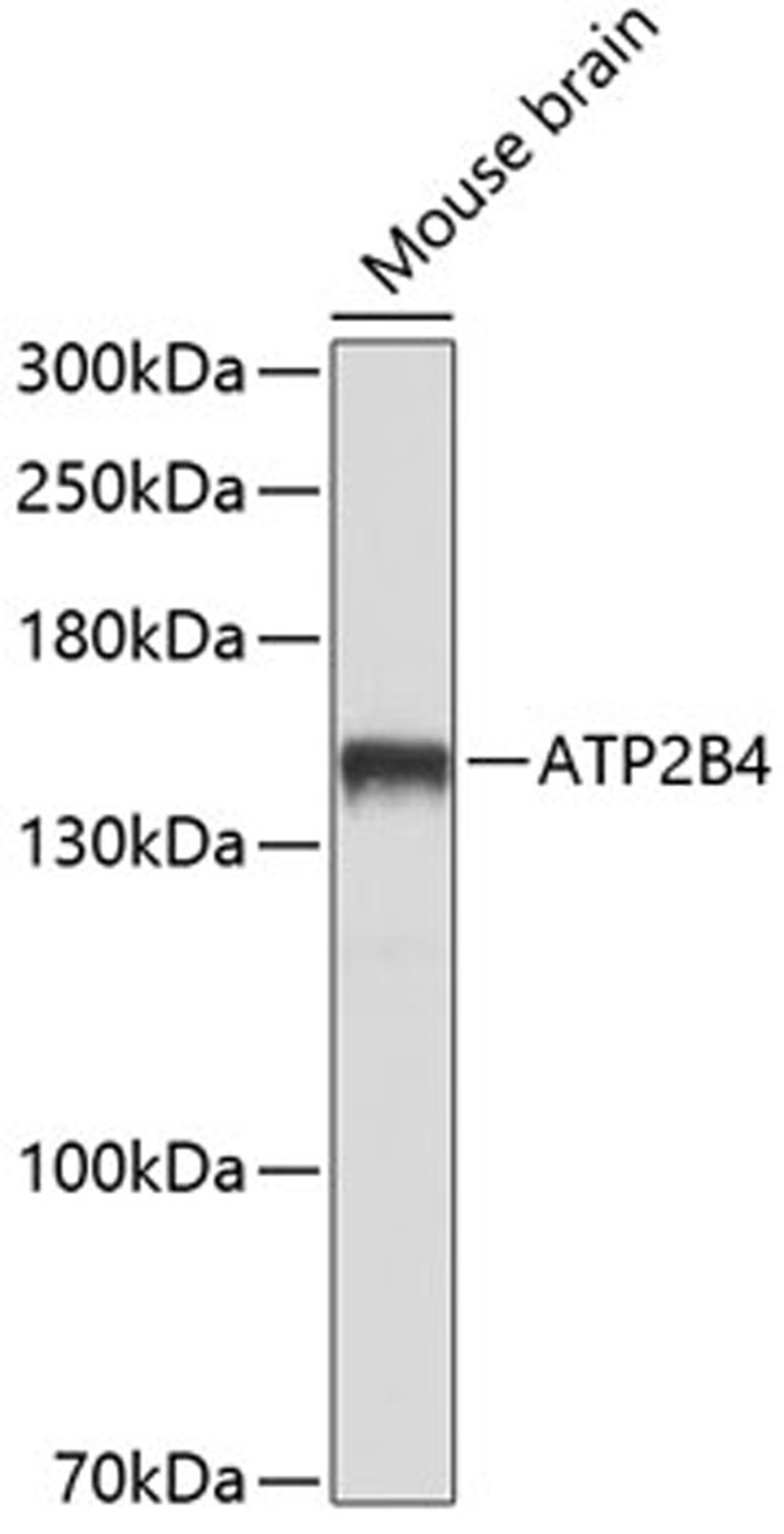 Western blot - ATP2B4 antibody (A10105)