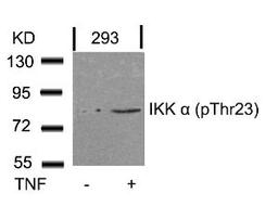 Western blot analysis of lysed extracts from 293 cells untreated or treated with TNF using IKK &#945; (Phospho-Thr23).