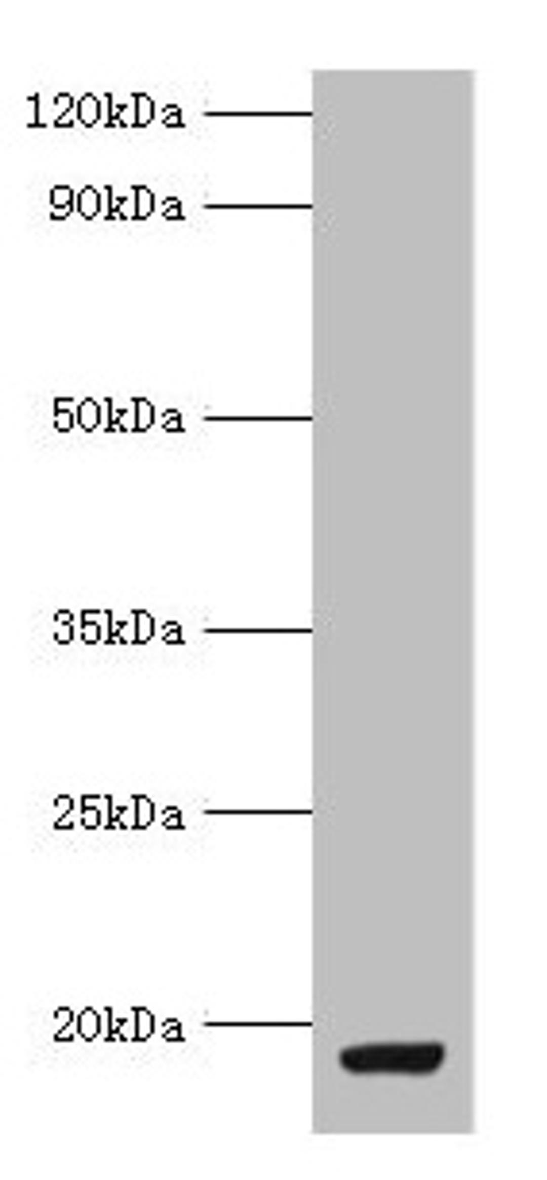 Western blot. All lanes: MYDGF antibody at 9µg/ml + MCF-7 whole cell lysate. Secondary. Goat polyclonal to rabbit IgG at 1/10000 dilution. Predicted band size: 19 kDa. Observed band size: 19 kDa
