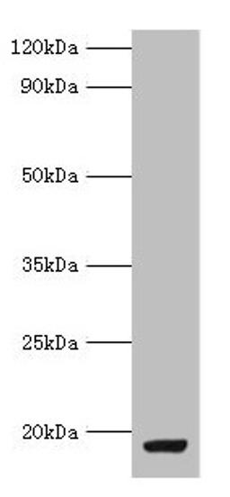 Western blot. All lanes: MYDGF antibody at 9µg/ml + MCF-7 whole cell lysate. Secondary. Goat polyclonal to rabbit IgG at 1/10000 dilution. Predicted band size: 19 kDa. Observed band size: 19 kDa
