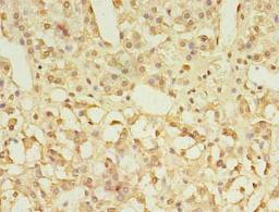 Immunohistochemistry of paraffin-embedded human adrenal gland tissue using CSB-PA009800LA01HU at dilution of 1:100