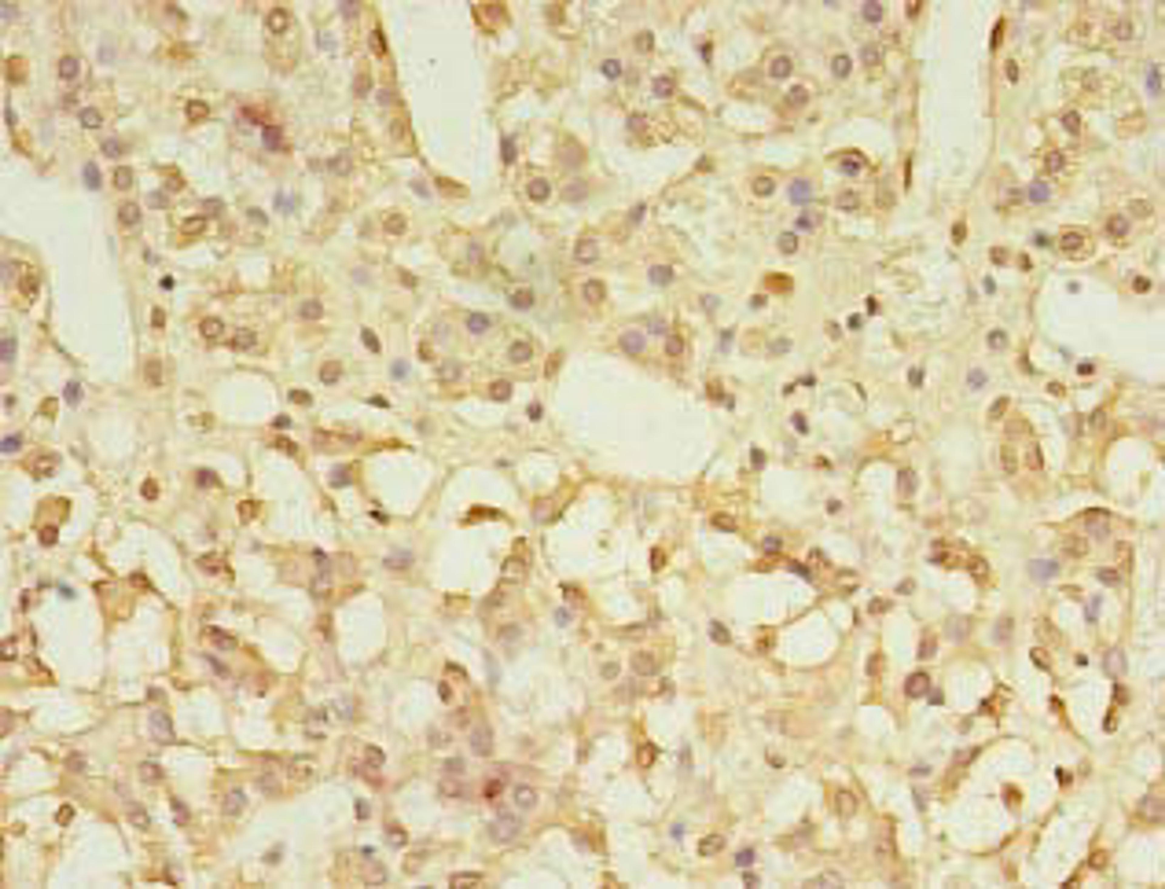 Immunohistochemistry of paraffin-embedded human adrenal gland tissue using CSB-PA009800LA01HU at dilution of 1:100