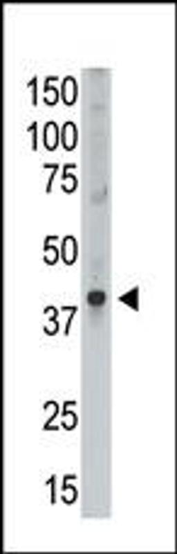 Antibody is used in Western blot to detect MAGEA9 in Placenta lysate.