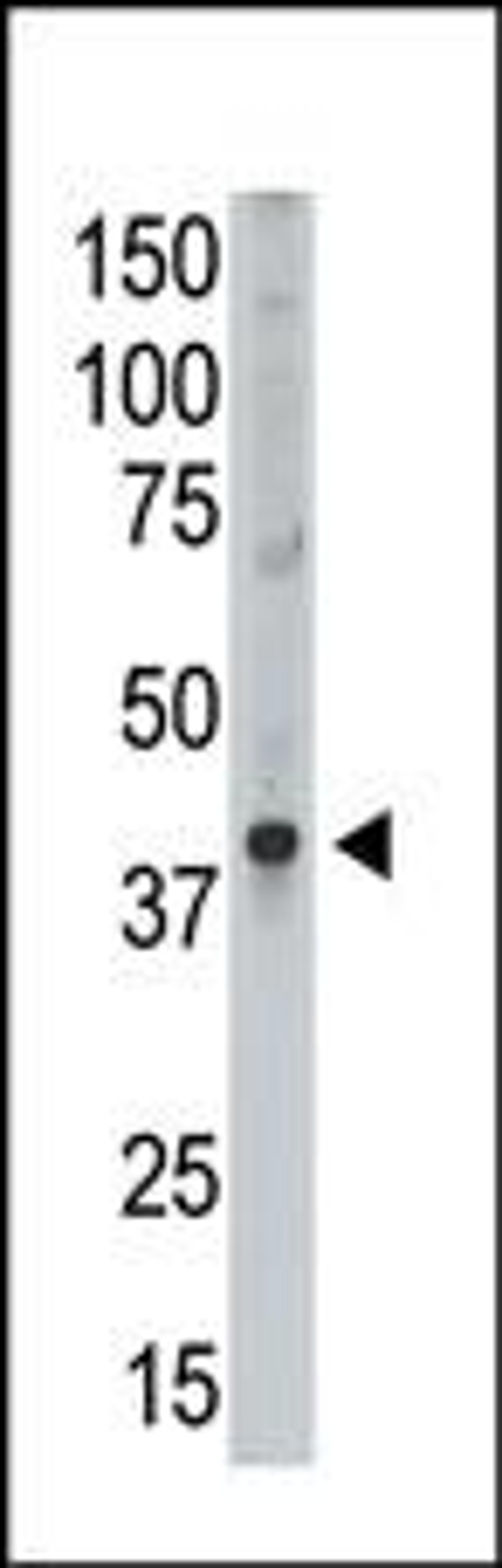 Antibody is used in Western blot to detect MAGEA9 in Placenta lysate.