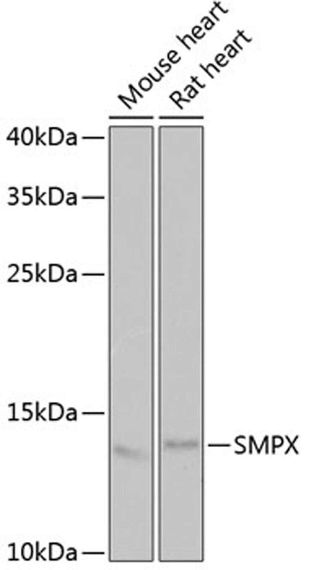 Western blot - SMPX antibody (A6744)