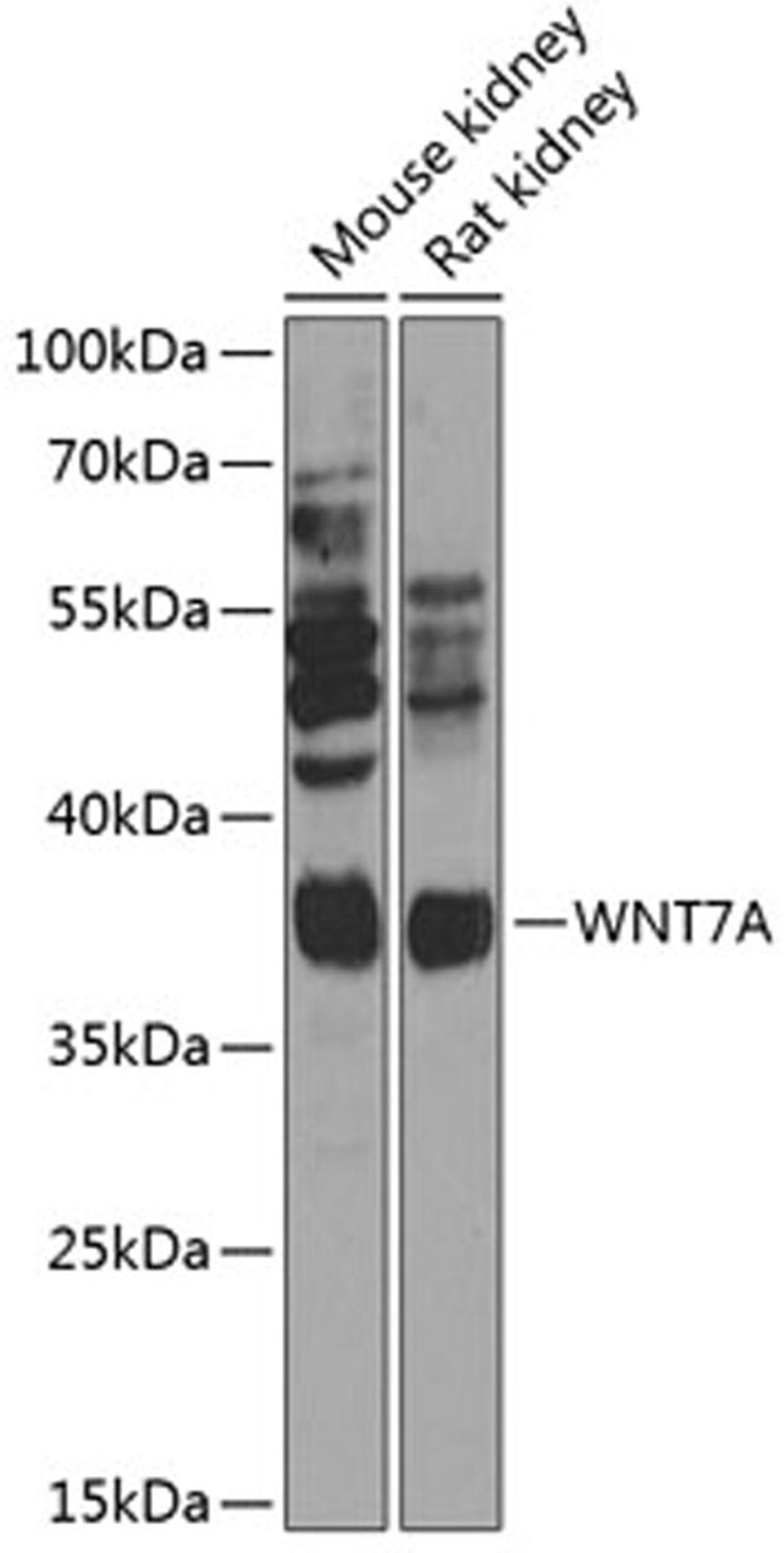 Western blot - WNT7A Antibody (A14194)