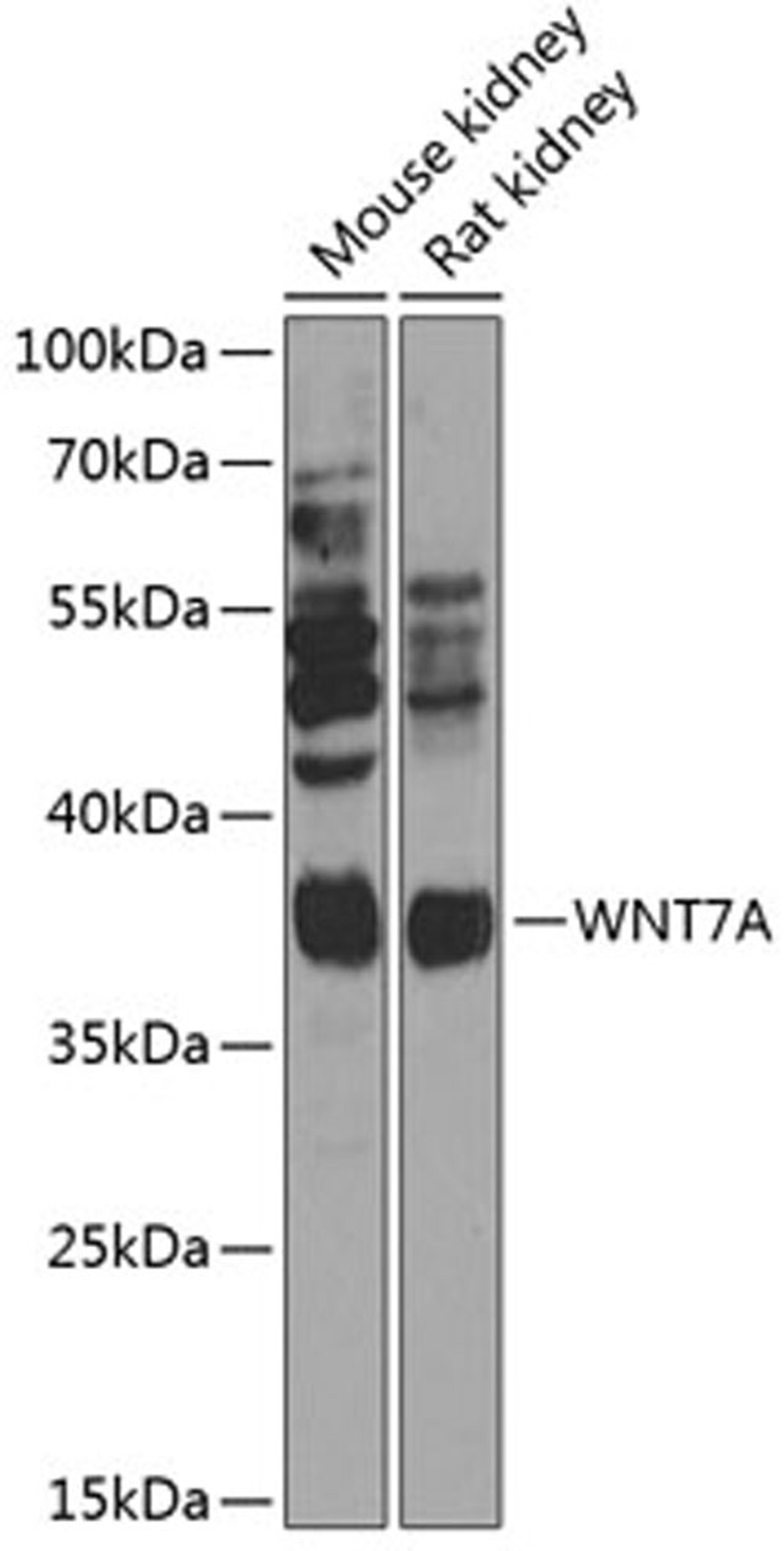 Western blot - WNT7A Antibody (A14194)