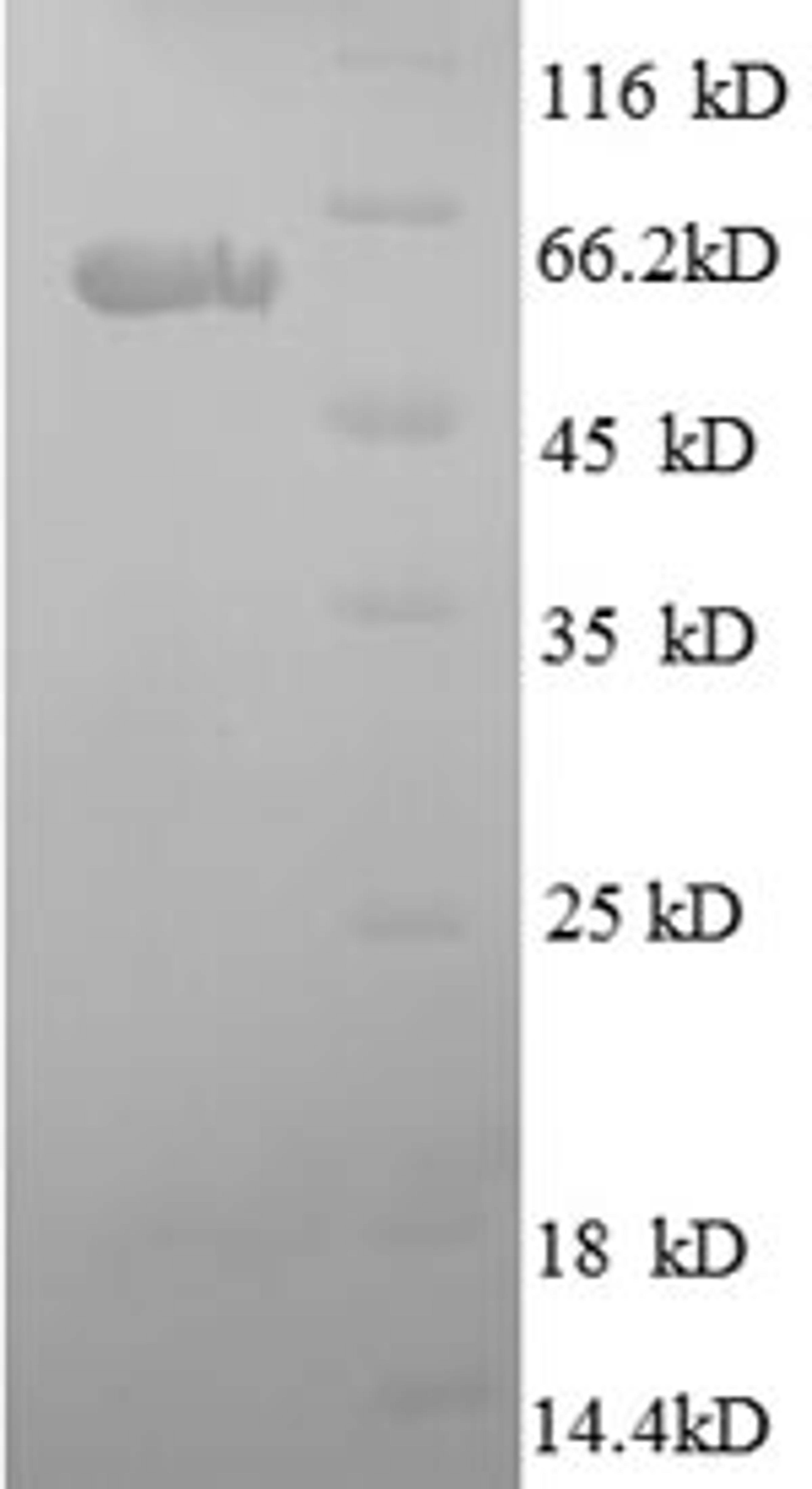 (Tris-Glycine gel) Discontinuous SDS-PAGE (reduced) with 5% enrichment gel and 15% separation gel.