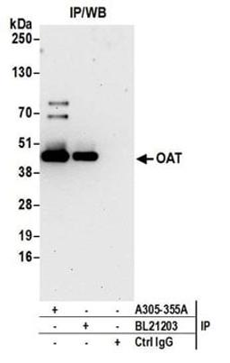 Detection of human OAT by western blot of immunoprecipitates.