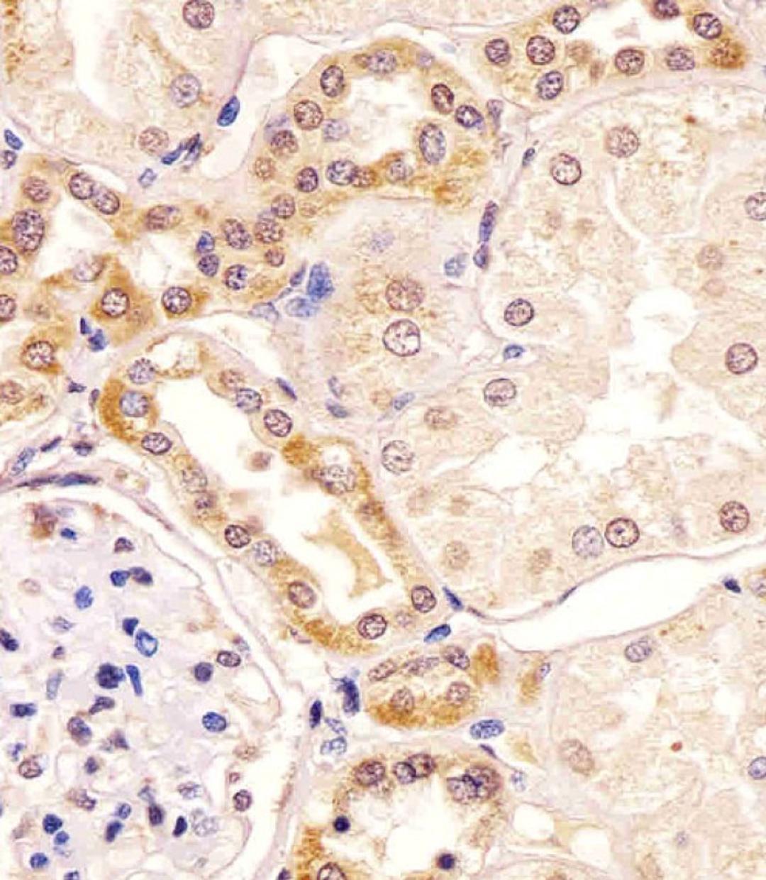 Antibody staining PKC beta1/2 in human kidney tissue sections by Immunohistochemistry (IHC-P - paraformaldehyde-fixed, paraffin-embedded sections).